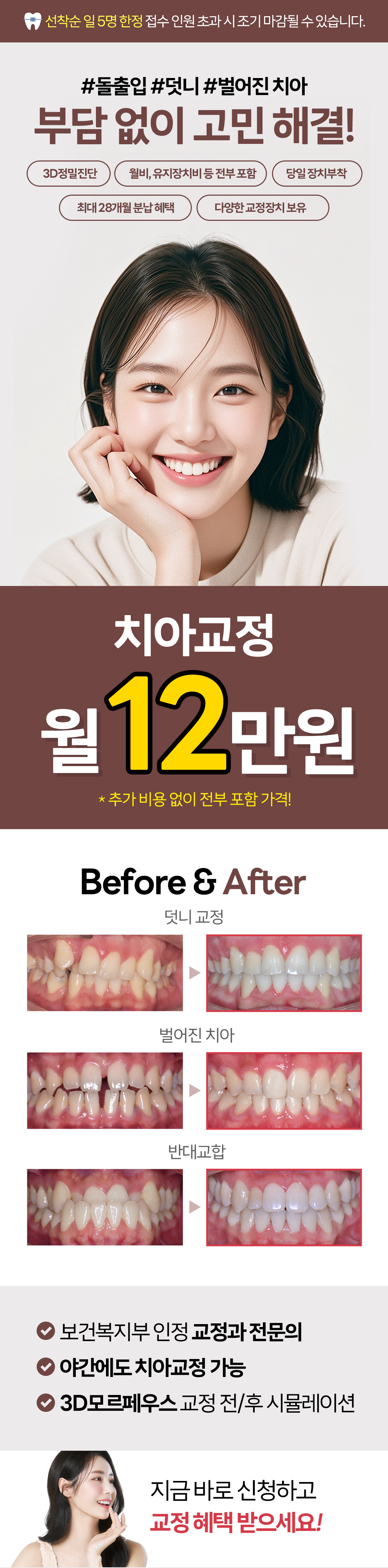 치아교정 할인 이벤트